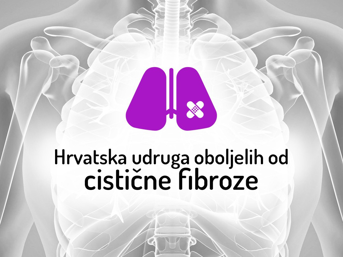 Nova stranica Udruge